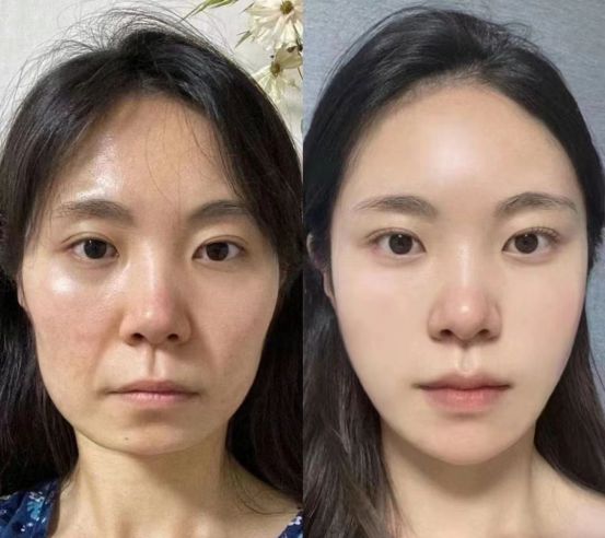 护肤品淡纹紧致肌肤这款我们的最爱AG真人国际网站十大最有效抗衰老(图6)