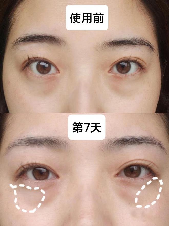 哪个牌子好？秋冬眼霜上岸指南少走弯路AG真人娱乐网址25岁男士眼霜去眼袋(图7)