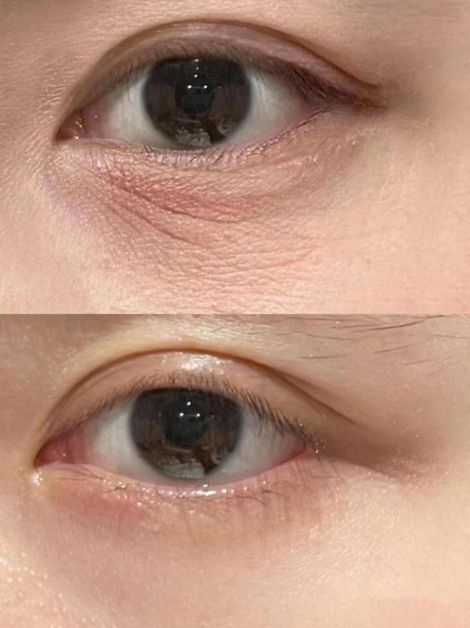 袋哪个牌子好？主打性价比的抗皱眼霜亲测AG真人百家家乐平台25岁男士眼霜去眼(图5)